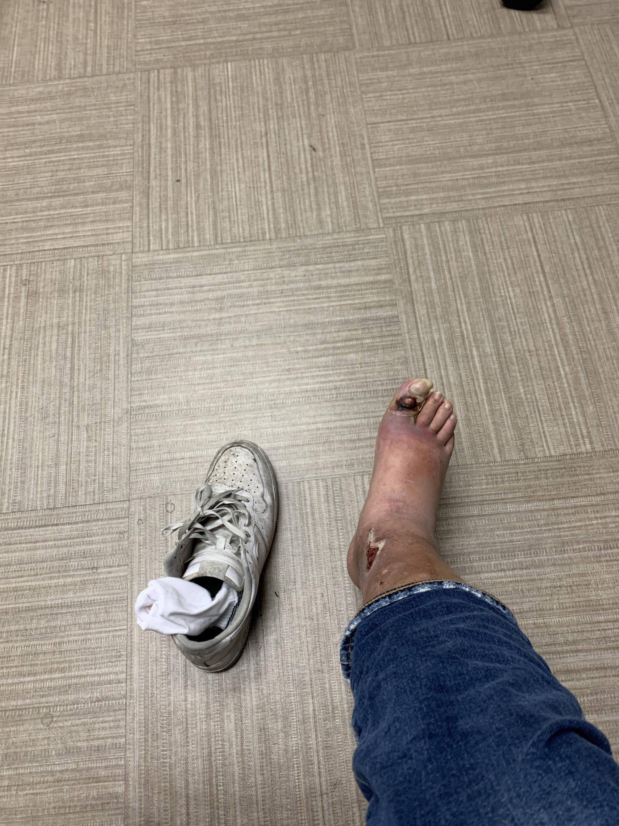 Ashley's beetfoot update.jpg